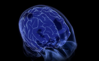 main brain image